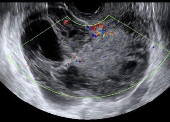 Casi del Mese di Febbraio 2022