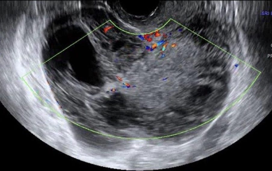 Casi del Mese di Febbraio 2022