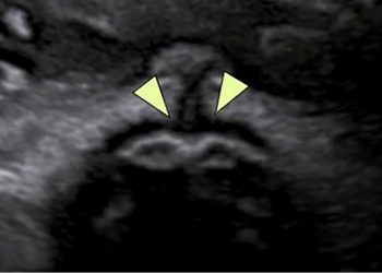 Casi del Mese di Marzo 2022