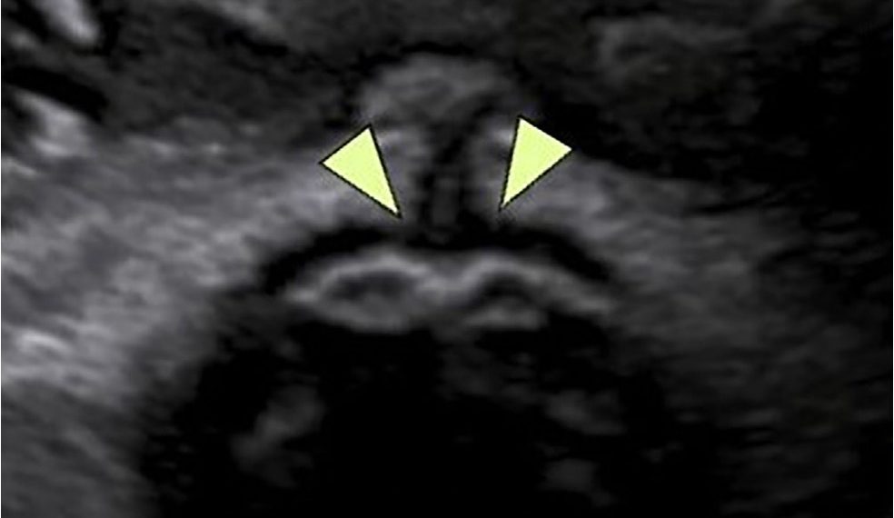 Casi del Mese di Marzo 2022