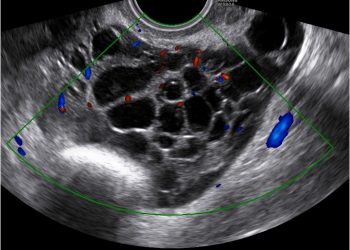 Casi del Mese di Aprile 2022