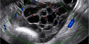 Casi del Mese di Aprile 2022