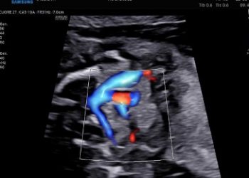 Casi del Mese di Maggio 2022