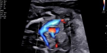 Casi del Mese di Maggio 2022