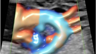 How To Do Maggio 2022: utilizzo del Doppler nello studio del cuore fetale