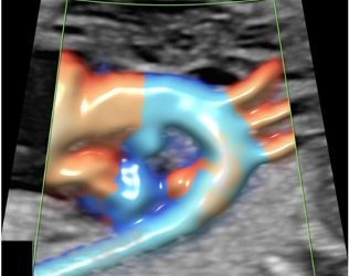 How To Do Maggio 2022: utilizzo del Doppler nello studio del cuore fetale