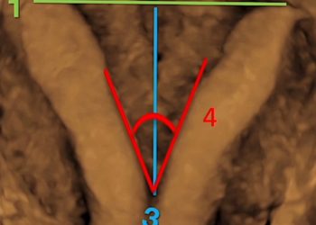 How To Do Giugno 2022: utilizzo del 3D nello studio dell’utero e dell’endometrio