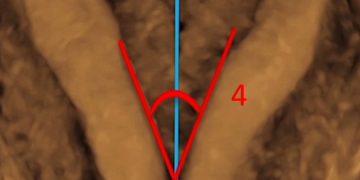 How To Do Giugno 2022: utilizzo del 3D nello studio dell’utero e dell’endometrio