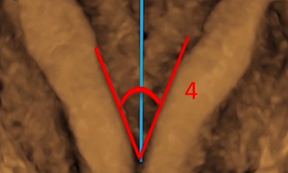 How To Do Giugno 2022: utilizzo del 3D nello studio dell’utero e dell’endometrio