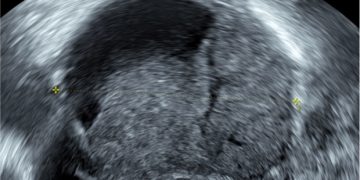 Casi del Mese di Giugno 2022