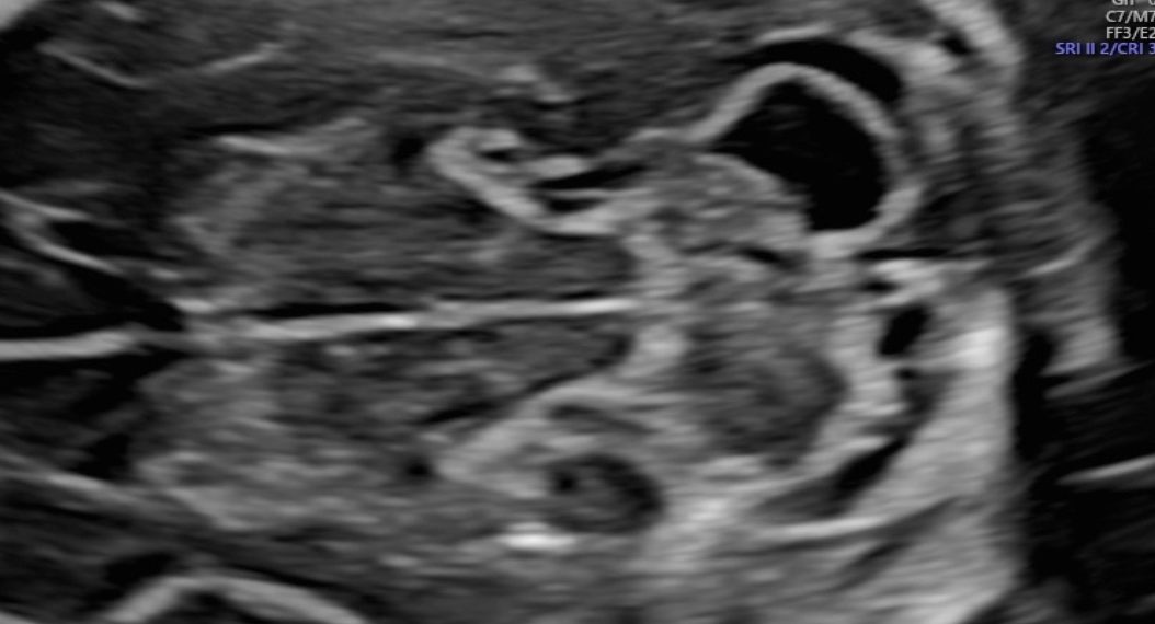 Casi del Mese di Luglio 2022