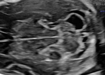 Casi del Mese di Luglio 2022