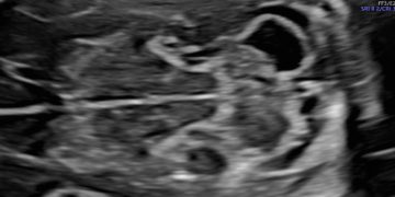 Casi del Mese di Luglio 2022