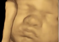 How To Do Agosto 2022: modalità di acquisizione dei volumi 3D e 4D in ostetricia