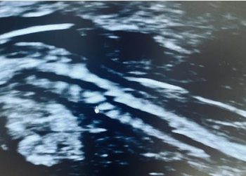 Casi del Mese di Agosto 2022