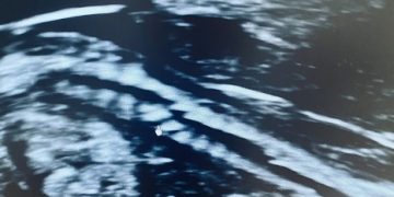 Casi del Mese di Agosto 2022