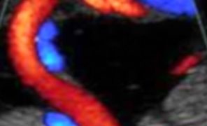 How To Do Settembre 2022: corretto settaggio del Doppler in ostetricia