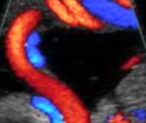 How To Do Settembre 2022: corretto settaggio del Doppler in ostetricia