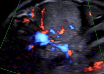 Casi del Mese di Settembre 2022