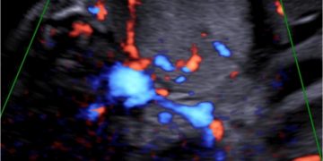 Casi del Mese di Settembre 2022