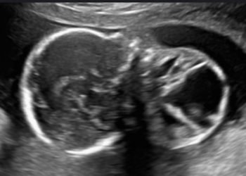 Casi del Mese di Ottobre 2022