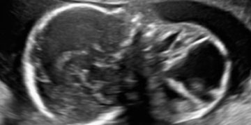 Casi del Mese di Ottobre 2022