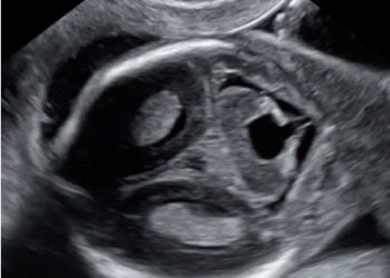 Casi del Mese di Novembre 2022