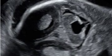 Casi del Mese di Novembre 2022