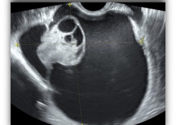 Casi del Mese di Dicembre 2022