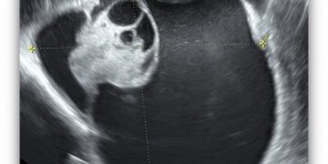 Casi del Mese di Dicembre 2022