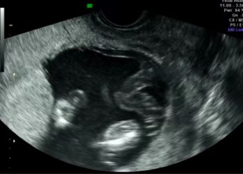 Casi del Mese di Gennaio 2023