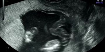 Casi del Mese di Gennaio 2023