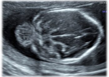 Casi del Mese di Marzo 2023