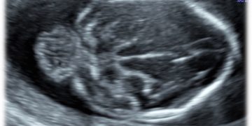 Casi del Mese di Marzo 2023