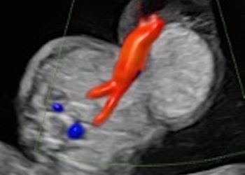 Guida al Counselling di Marzo 2023: onfalocele