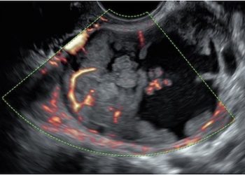 How To Do Marzo 2023: Terminologia e Classificazione IOTA
