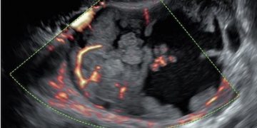 How To Do Marzo 2023: Terminologia e Classificazione IOTA