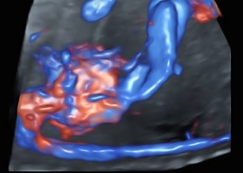 How To Do Aprile 2023: vascolarizzazione addominale fetale