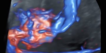 How To Do Aprile 2023: vascolarizzazione addominale fetale