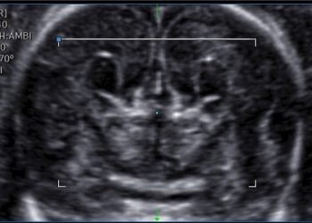 Casi del Mese di Aprile 2023