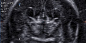 Casi del Mese di Aprile 2023