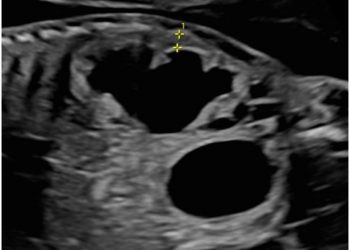 Casi del Mese di Maggio 2023