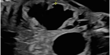 Casi del Mese di Maggio 2023