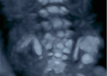 Casi del Mese di Giugno 2023