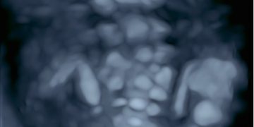 Casi del Mese di Giugno 2023