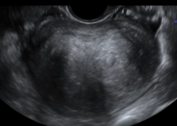 How To Do Luglio 2023: terminologia e classificazione MUSA