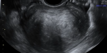 How To Do Luglio 2023: terminologia e classificazione MUSA