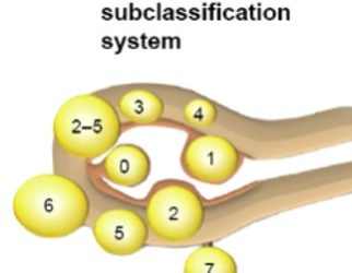 Guida al Counselling di Luglio 2023: Fibromi uterini