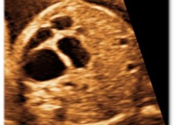 Casi del Mese di Luglio 2023