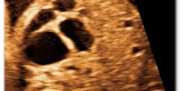 Casi del Mese di Luglio 2023